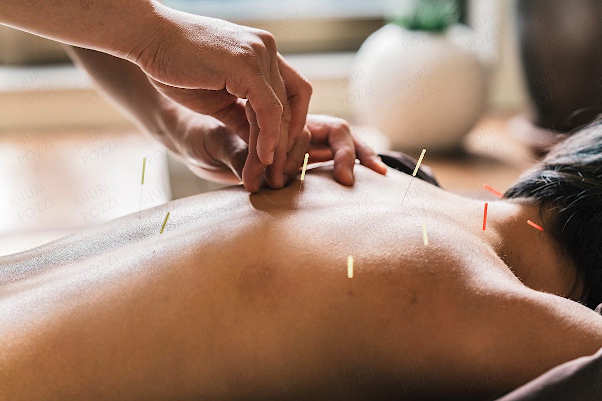 Akupunktursuz Sertleşme Sorunu Tedavisi